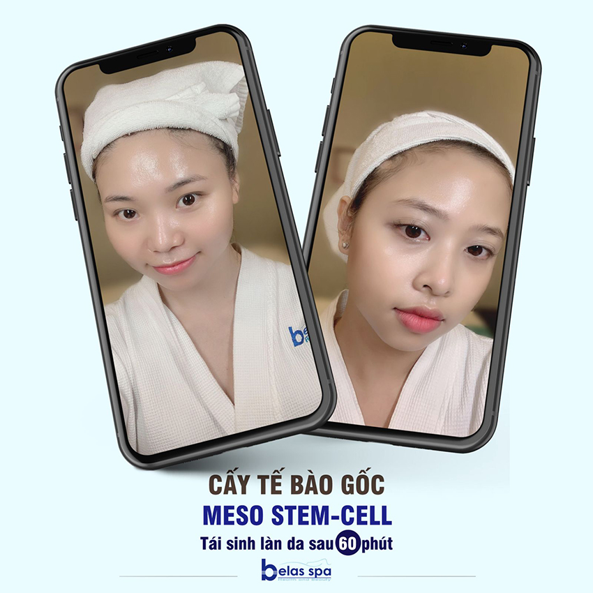 te-bao-go-meso-stem-cell