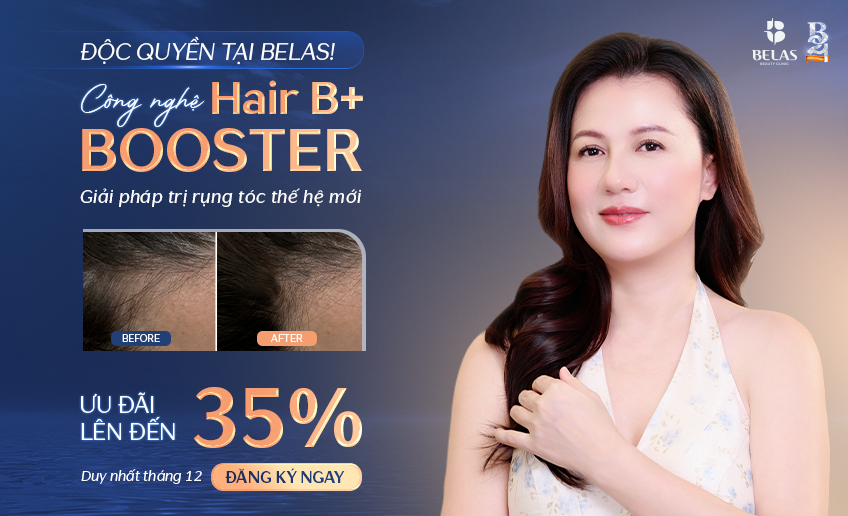 khuyen mai lam dep belas