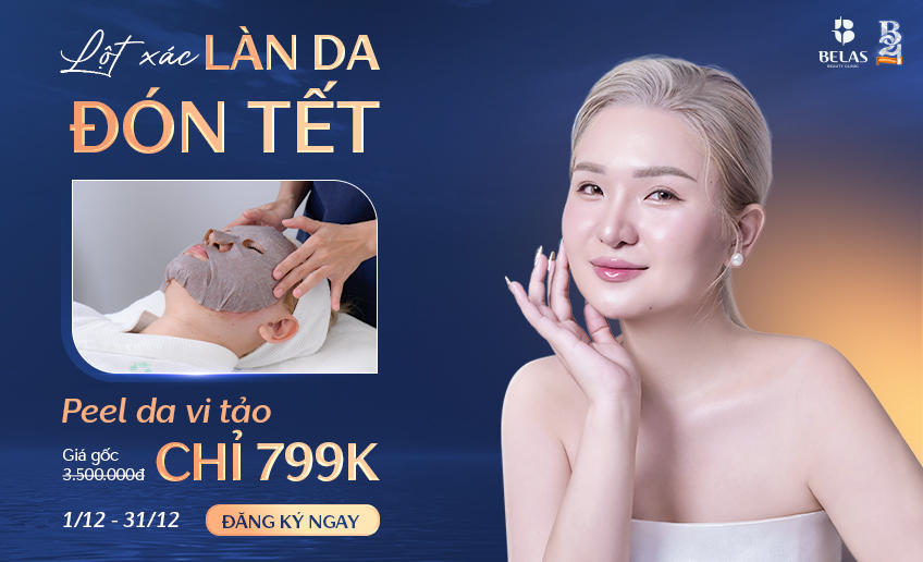 khuyen mai sinh nhat belas